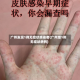 广州发现1例无症状感染者(广州增1例无症状病例)