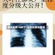 肺炎北京10例了/北京的肺炎情况