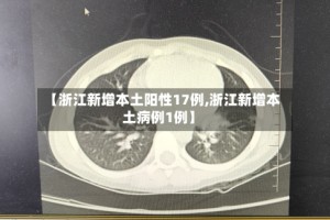 【浙江新增本土阳性17例,浙江新增本土病例1例】