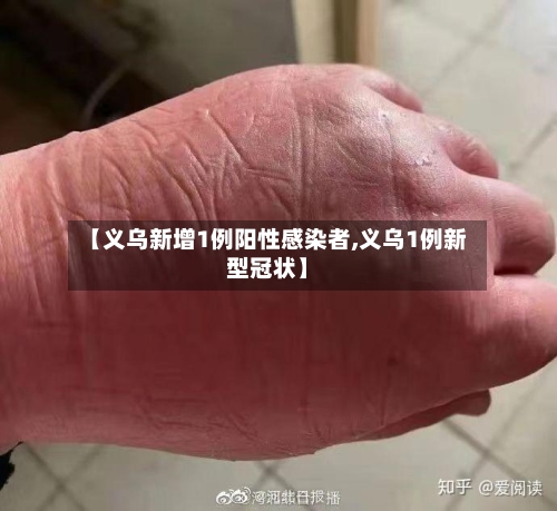 【义乌新增1例阳性感染者,义乌1例新型冠状】-第2张图片