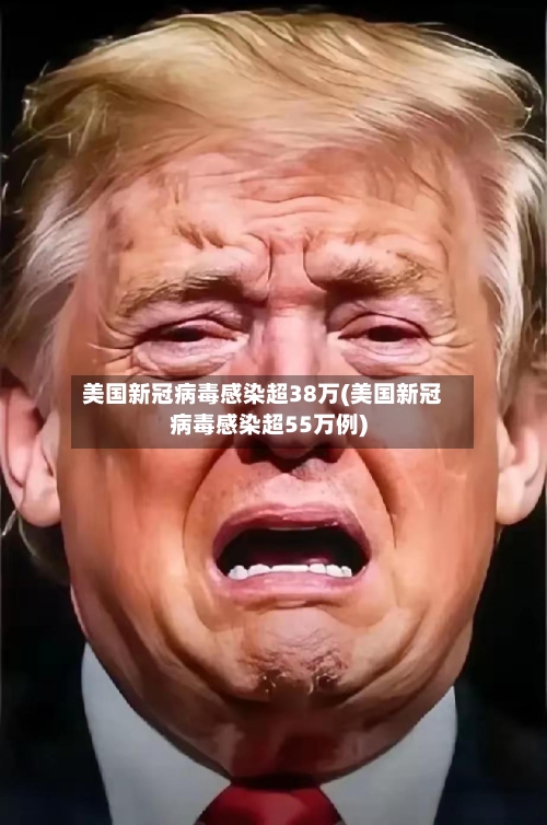 美国新冠病毒感染超38万(美国新冠病毒感染超55万例)-第3张图片