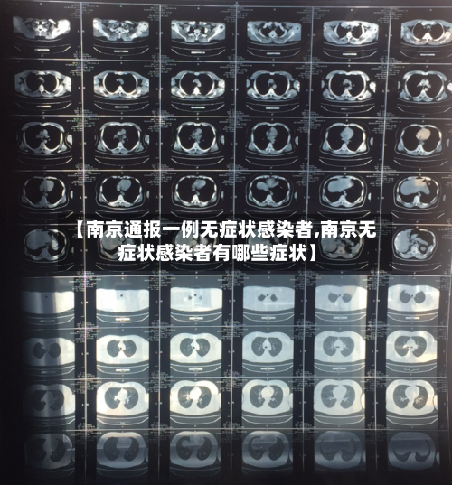 【南京通报一例无症状感染者,南京无症状感染者有哪些症状】-第3张图片